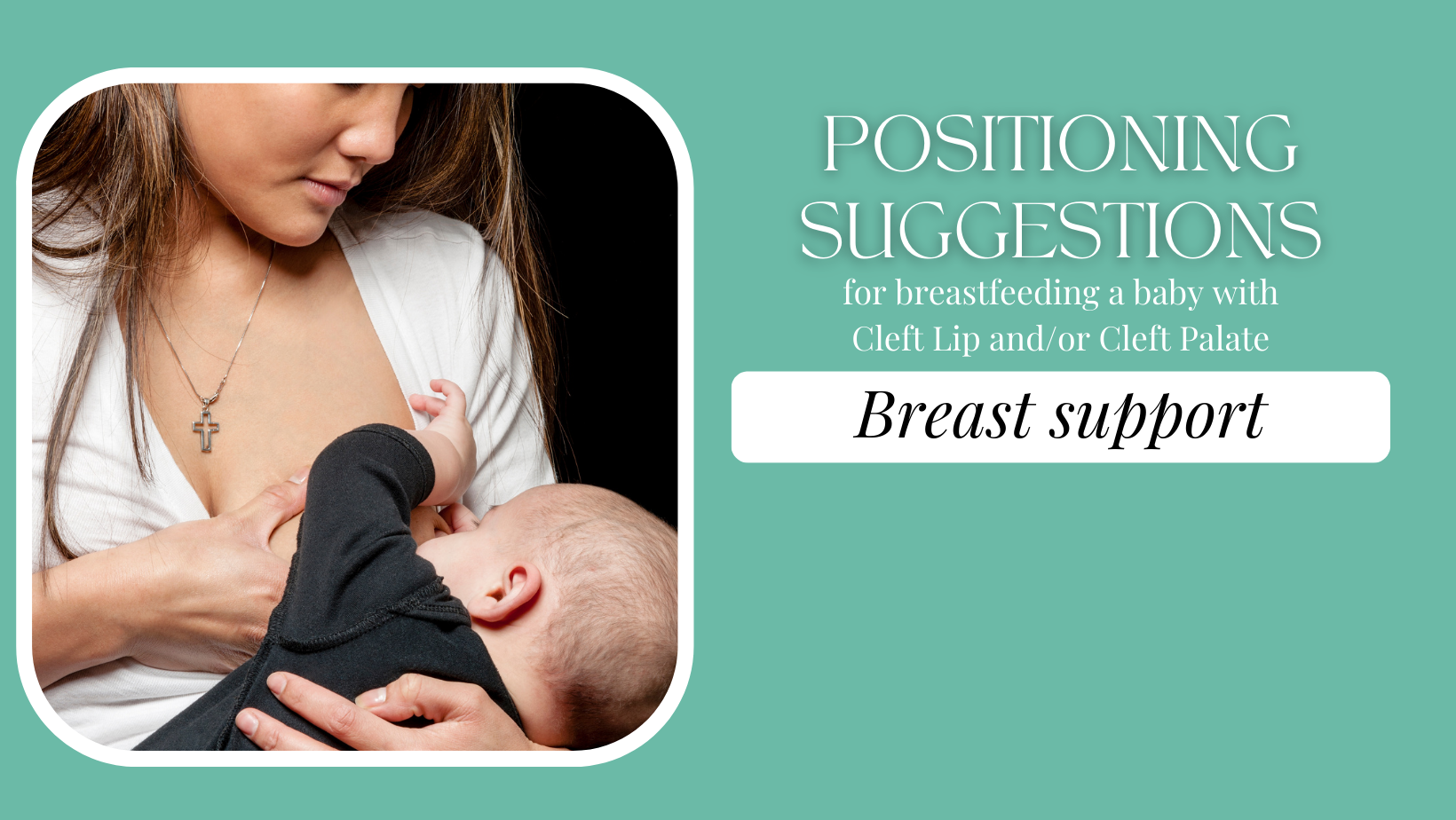 Feeding a Baby with a Cleft Lip and/or Cleft Palate La Leche League Canada Breastfeeding